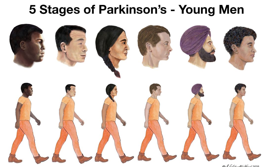 5 Stages of Parkinson’s – Young Men